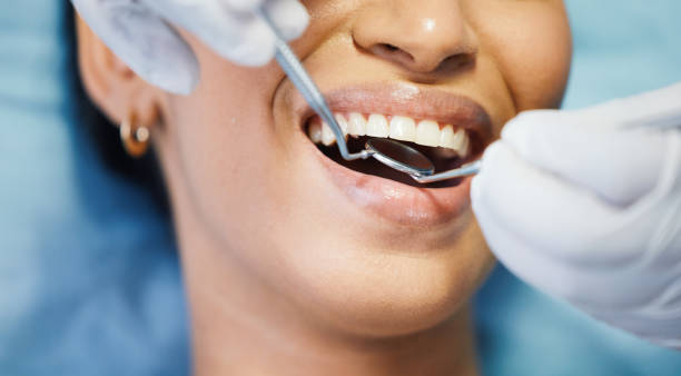 Best Emergency Tooth Extraction in Cactus, TX