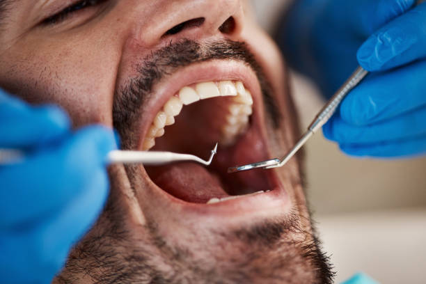 Best Emergency Broken Tooth Repair in Cactus, TX